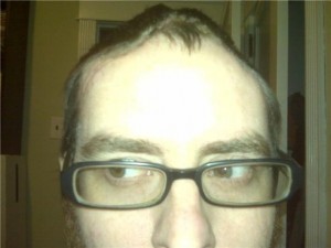 Did it hurt you worse than this, Darin?